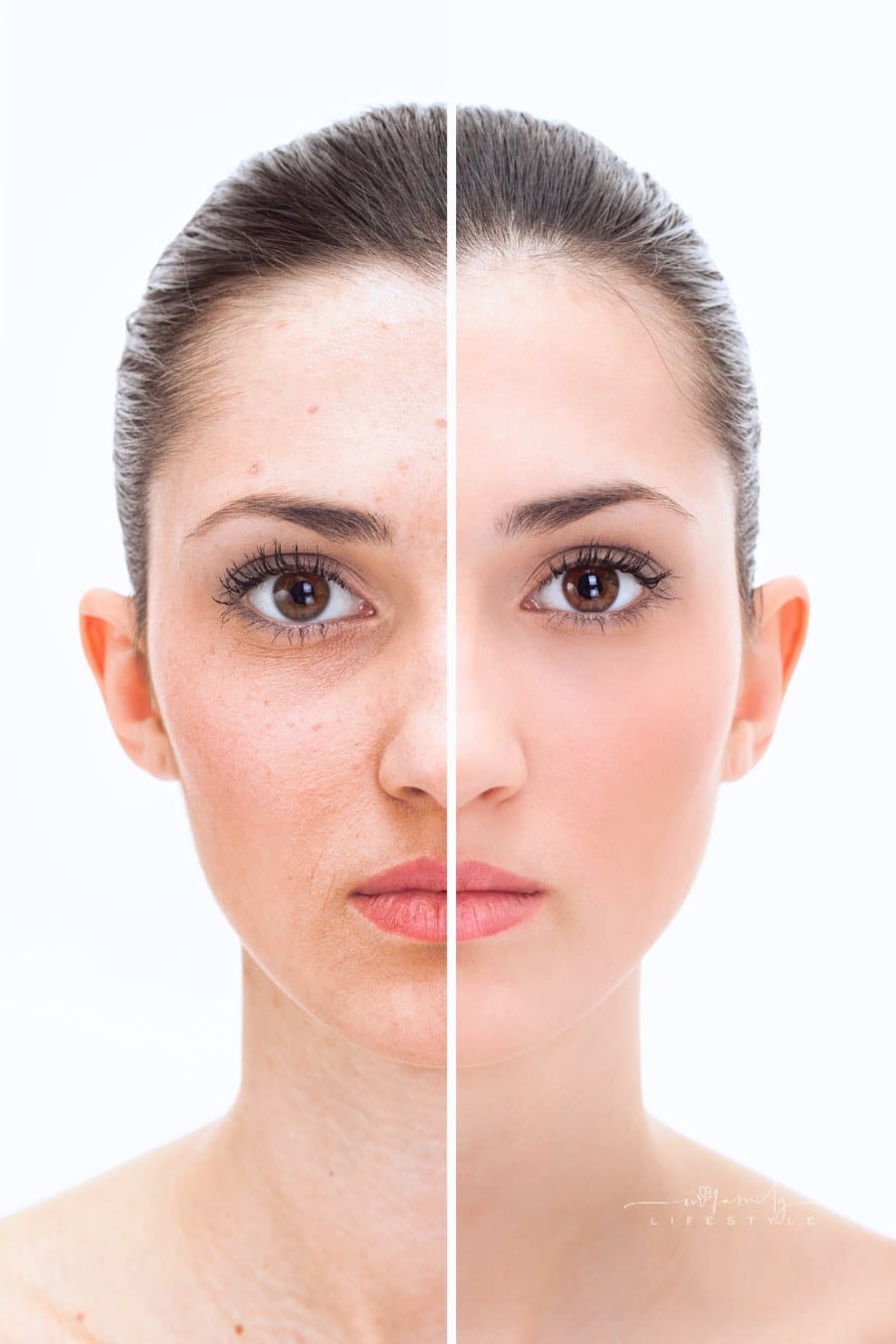 beauty concept before and after retouch