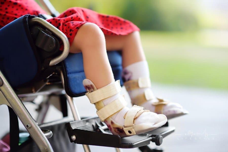 Cerebral Palsy and Birth Injuries: Legal Considerations and Support