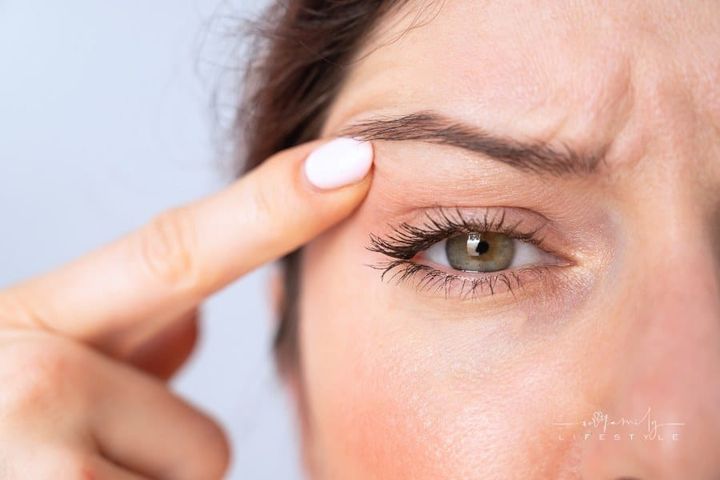 Close-up Portrait of Caucasian Middle-Aged Woman Pointing to the Wrinkles on the Upper Eyelid. Signs of Aging on the Face