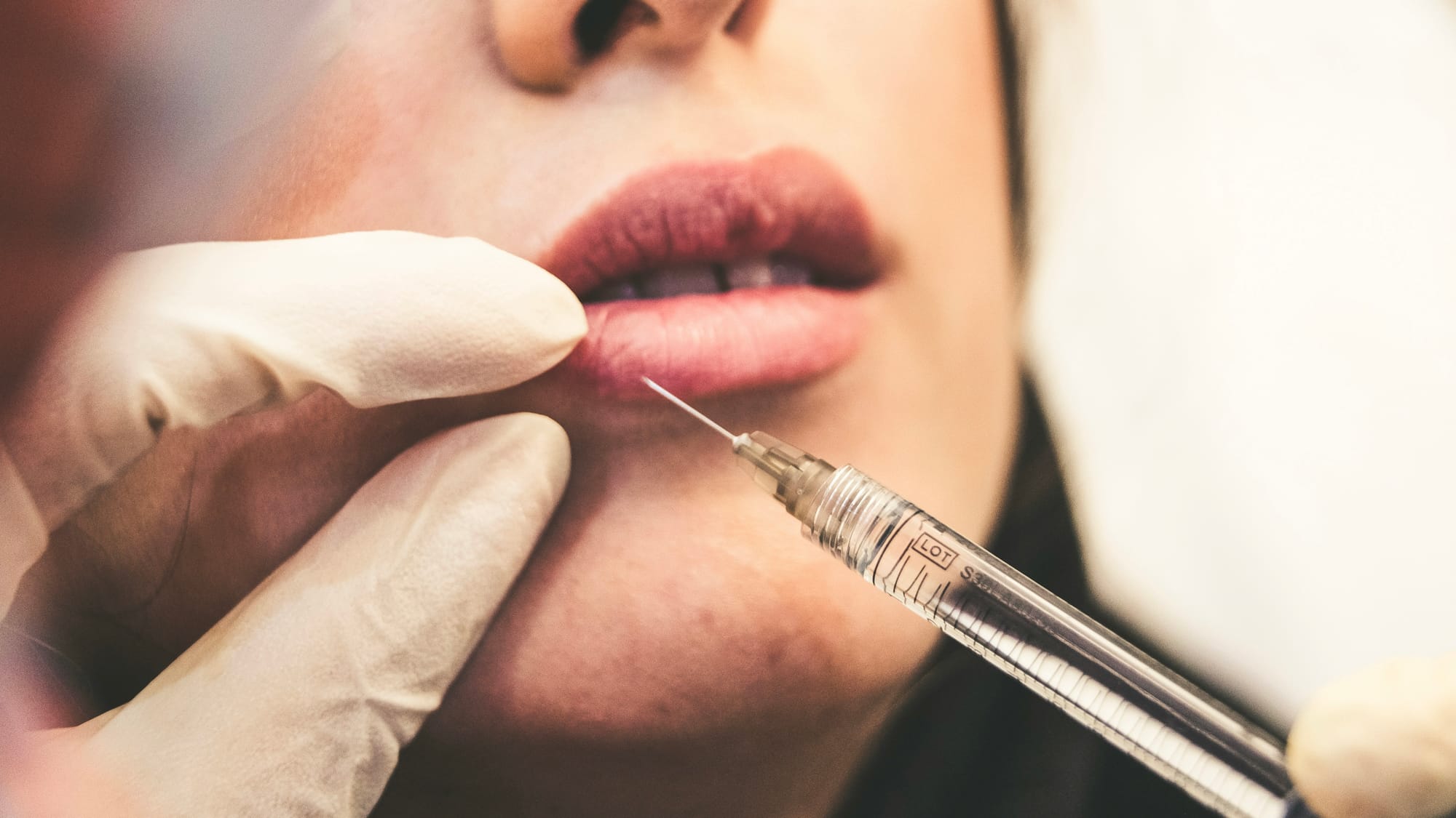 Two women held in custody after fatal illegal botox injection in Nice