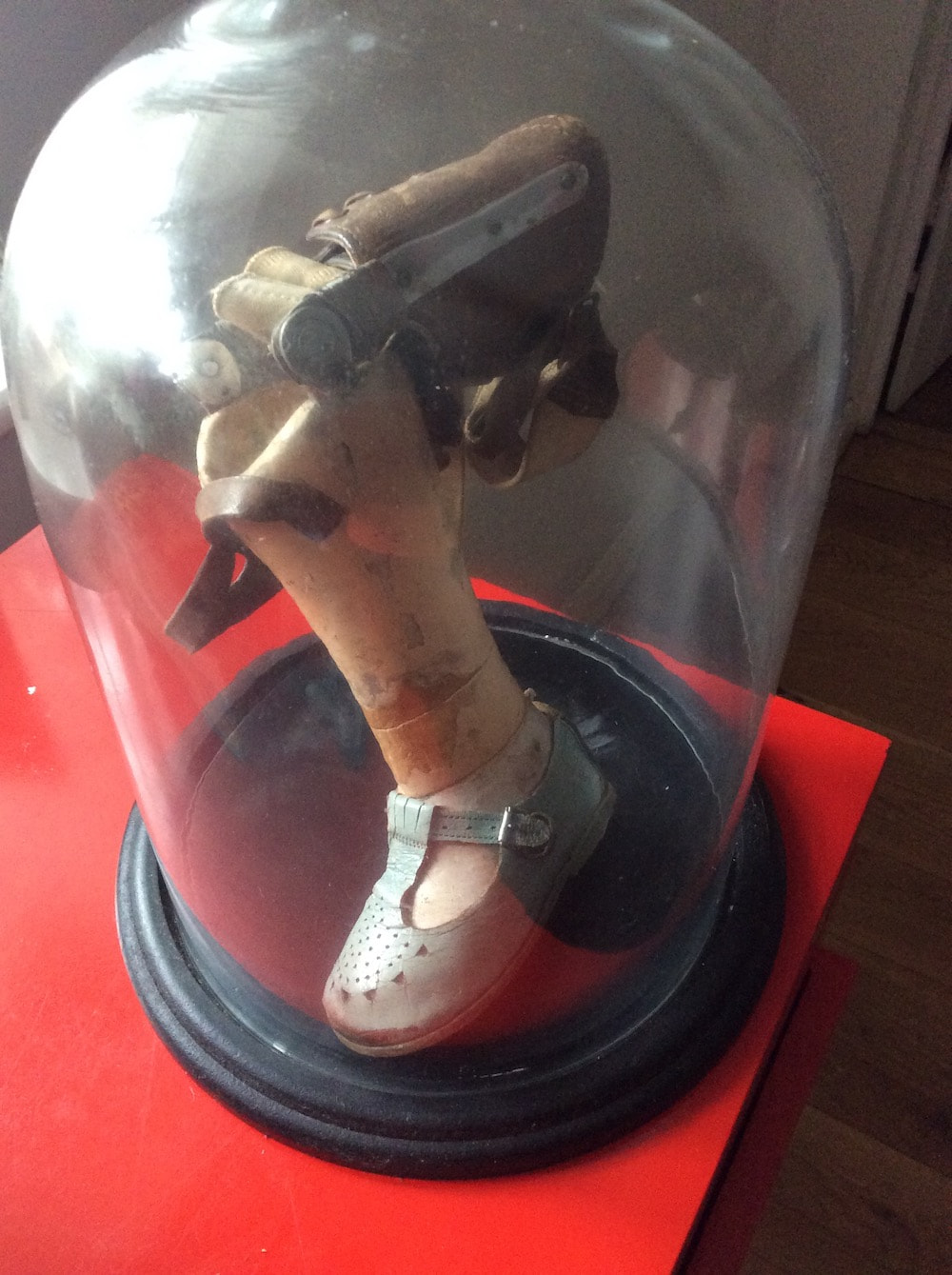 Jackie's childhood prosthetic leg
