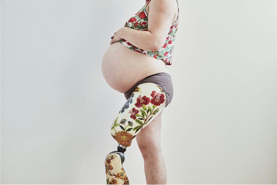 Taking Action: The Woman Who Created Her Own Disability Maternity Photos