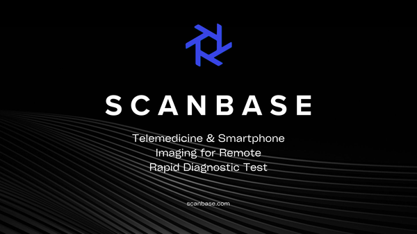 Telemedicine & Smartphone Imaging for Remote Rapid Diagnostic Test