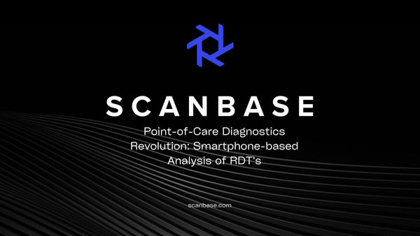 Point-of-Care Diagnostics Revolution: Smartphone-based Analysis of RDT's