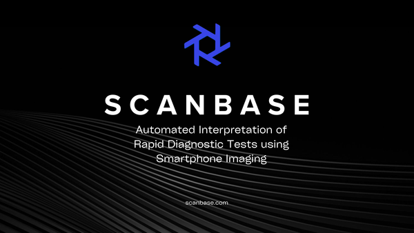 Automated Interpretation of Rapid Diagnostic Tests using Smartphone Imaging