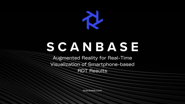 Augmented Reality for Real-Time Visualization of Smartphone-based RDT Results