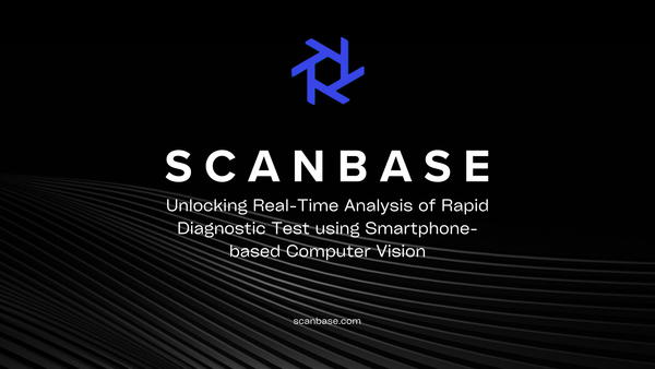 Unlocking Real-Time Analysis of Rapid Diagnostic Test using Smartphone-based Computer Vision
