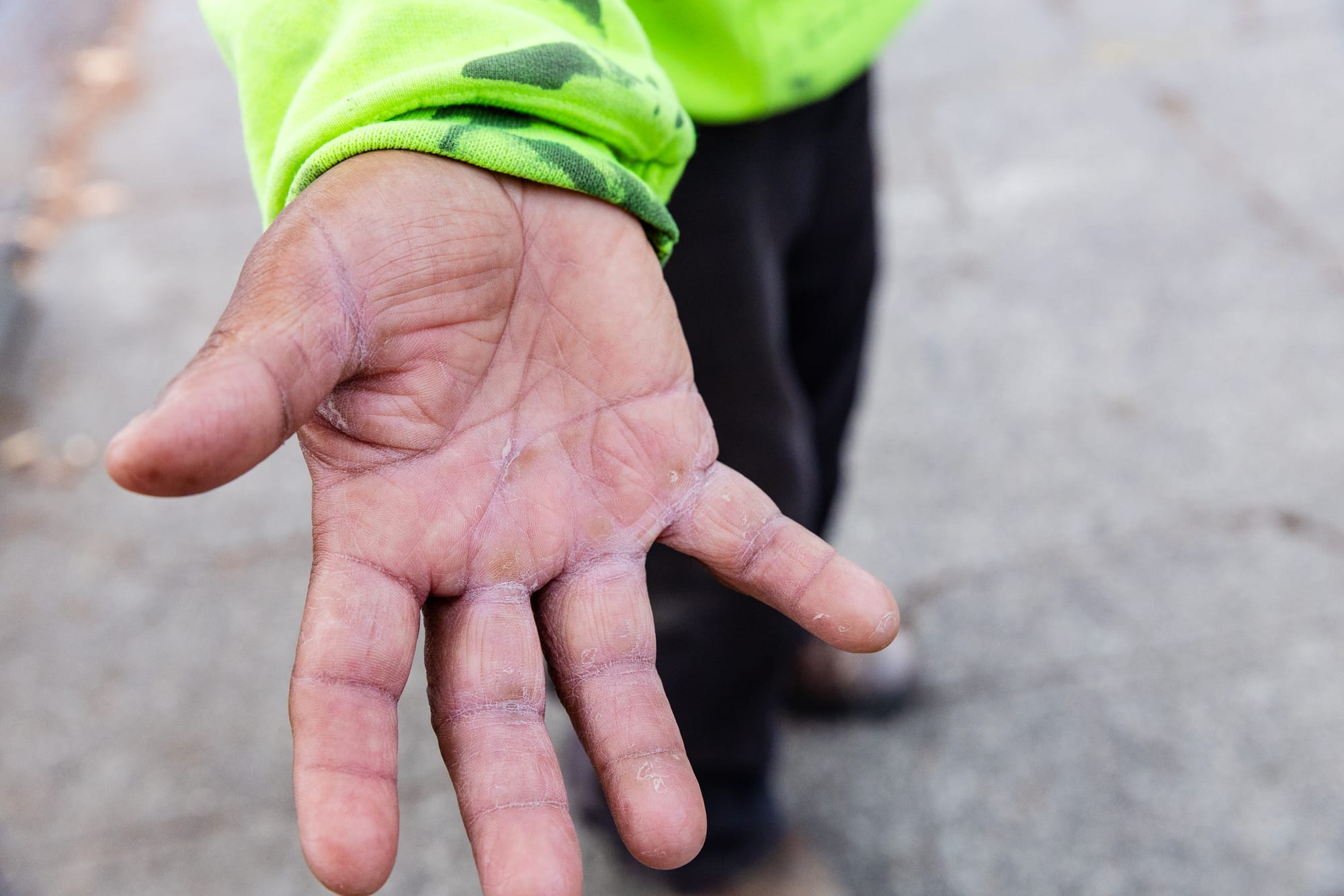 a close-up of a man's calloused hands