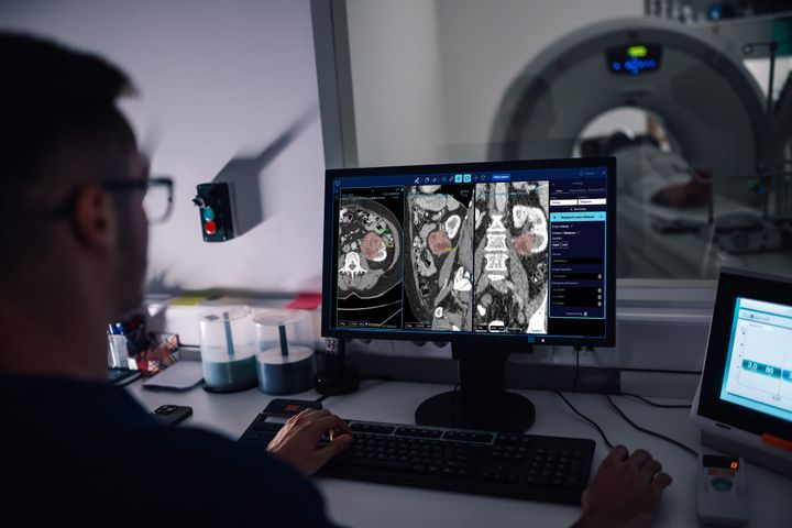Estonian cancer AI caught four tumours radiologists had missed