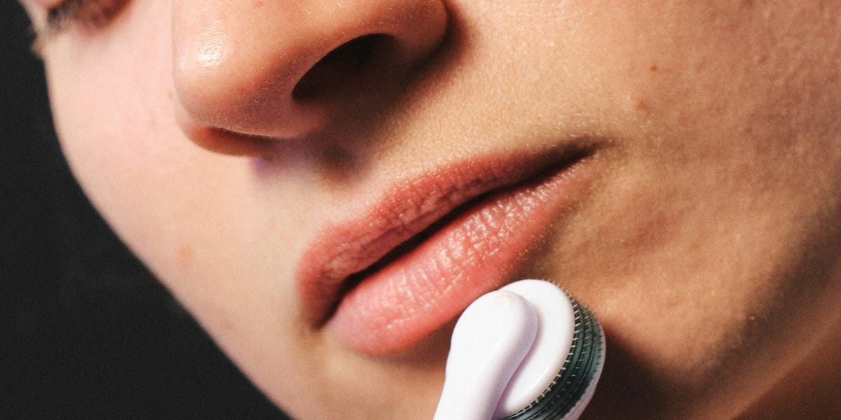 What Is Microneedling? The Expert Guide to the Popular Skincare Treatment