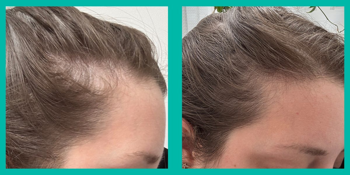 These Hair Growth Capsules Are Tailored for Stress and Hormone-Related Thinning. We Put Them to the Test for Eight Weeks.