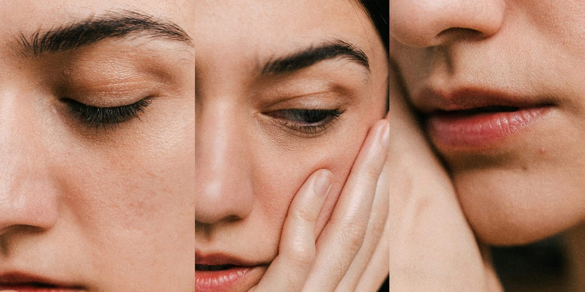What Stress Really Does to Your Skin