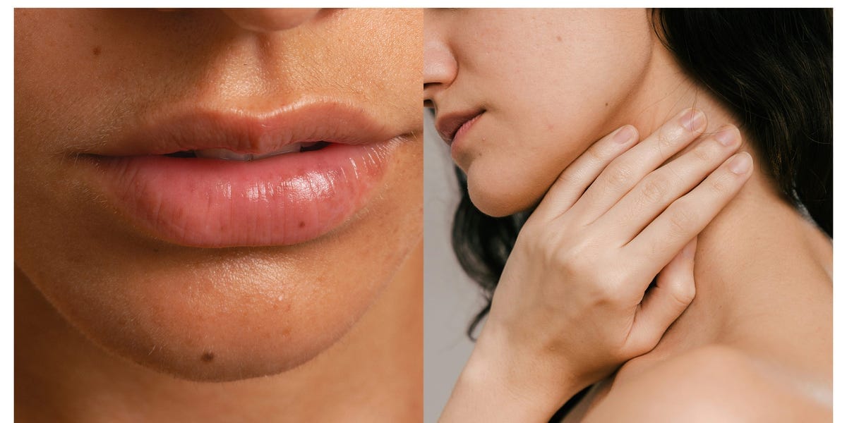 I’m a Chronic Jaw Clencher, but These Expert Treatments Help Me Through It