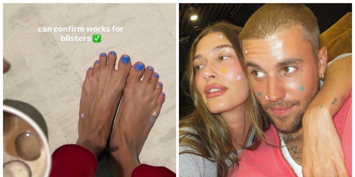 Why Is Hailey Bieber Wearing Pimple Patches on Her Feet?