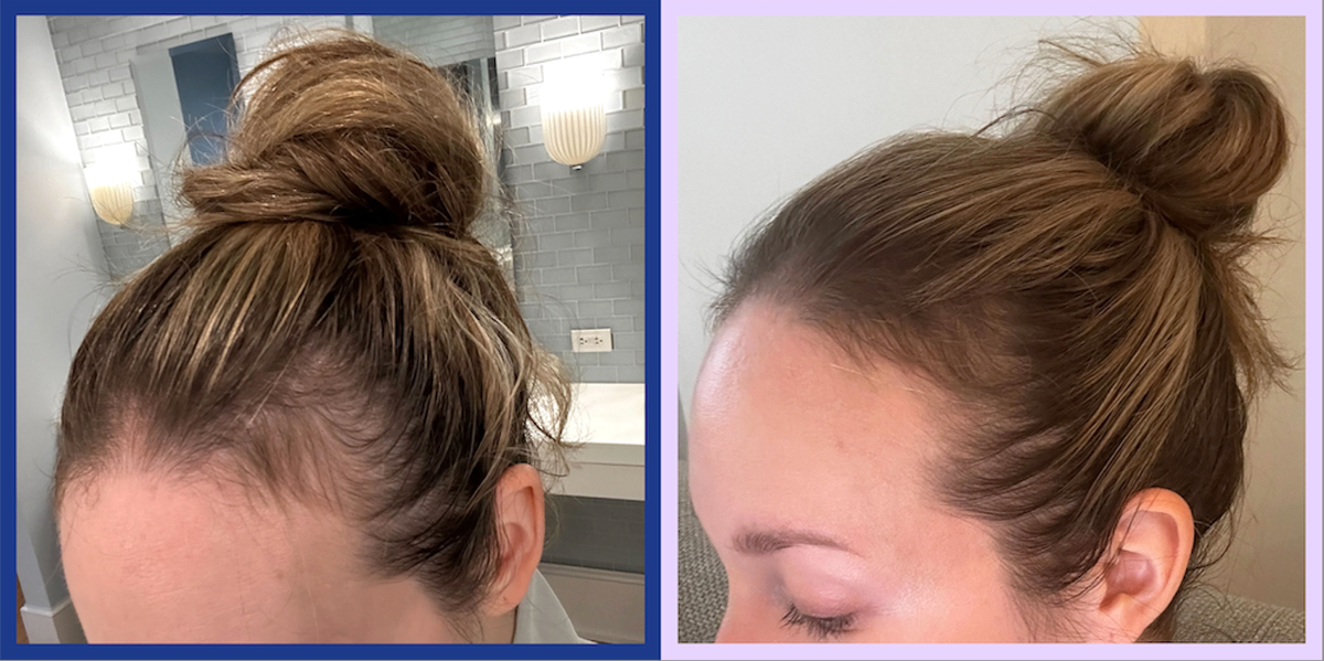 The 7 Best Supplements For Hair Growth, According To Beauty Experts