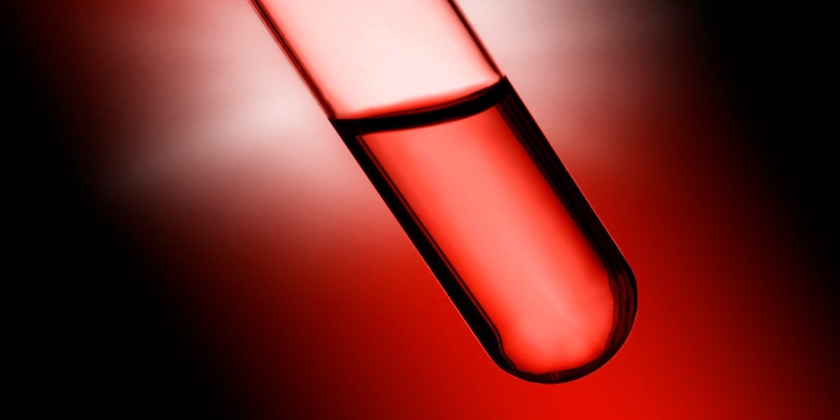 The FDA Approved a New Alzheimer’s Blood Test for People Over the Age of 55. Here’s What It Can—and Can’t—Tell You