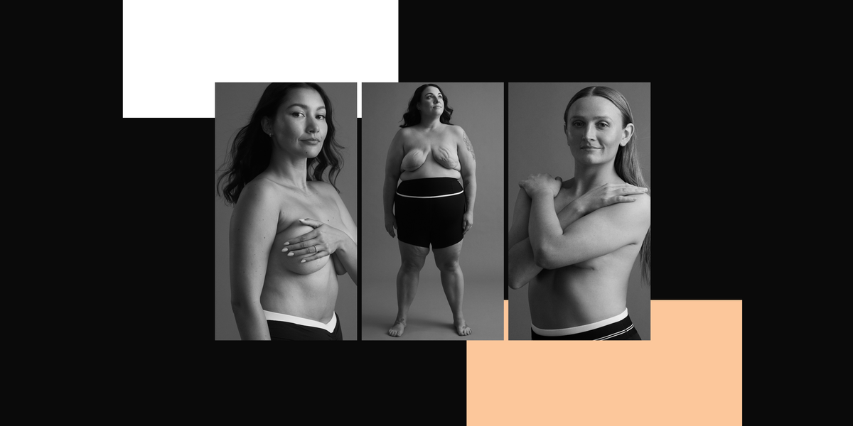 The Young Women Who Chose to Have Preventive Double Mastectomies