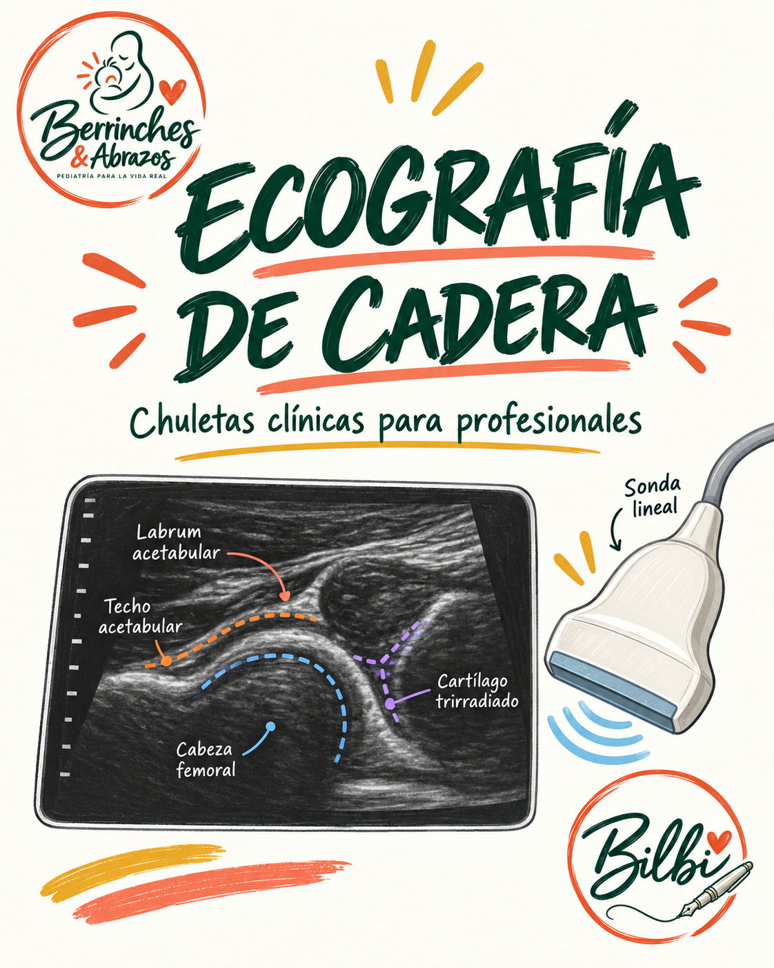 Ecografía de cadera