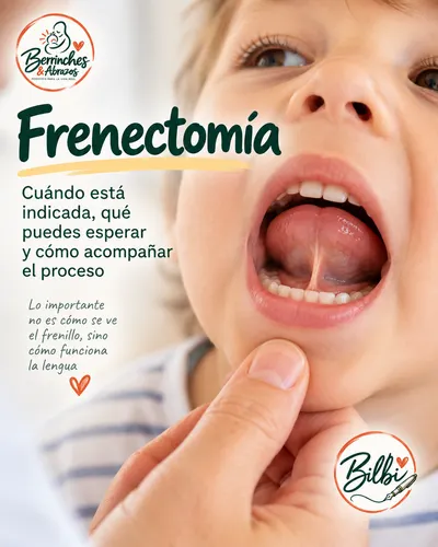 El frenillo de tu bebé: por qué antes de cortar hay que mirar bien primero