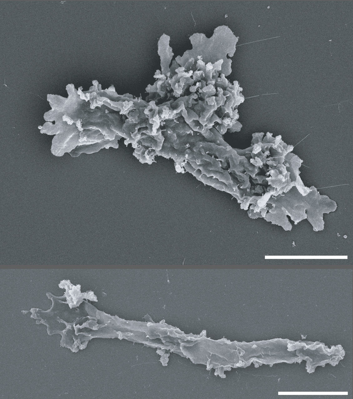 Black-and-white microscope image of two Incendiamoeba cascadensis cells.