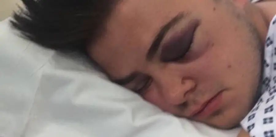 Man, 20, left with bleed on brain and broken eye socket after “unprovoked” late night attack in Altrincham