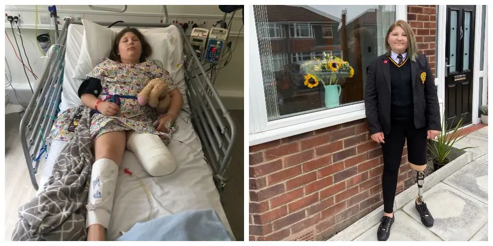 Bone cancer survivor becomes Bowdon charity’s first Young Ambassador