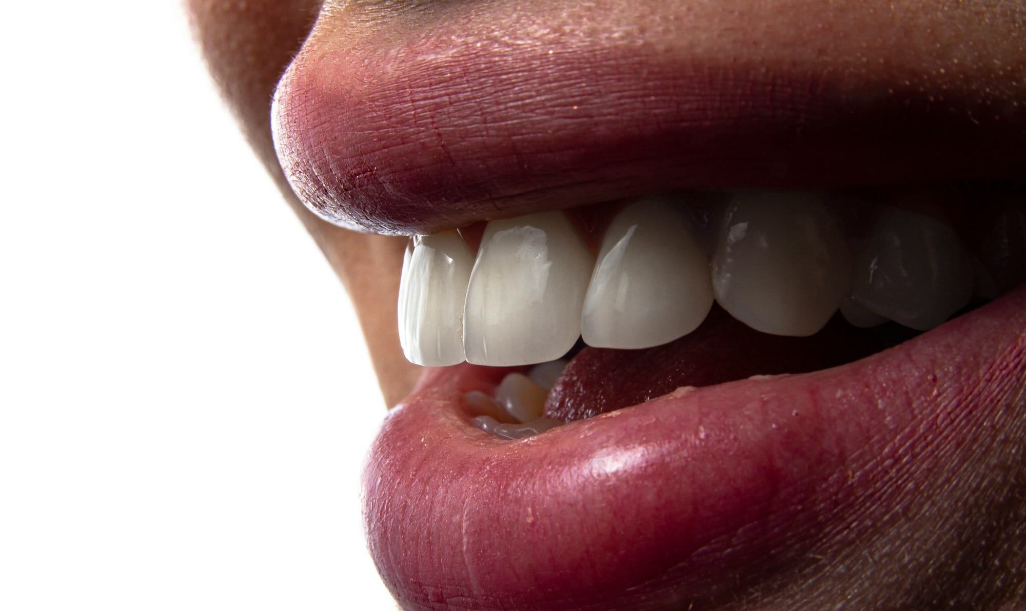 a close-up of a person's mouth with teeth showing