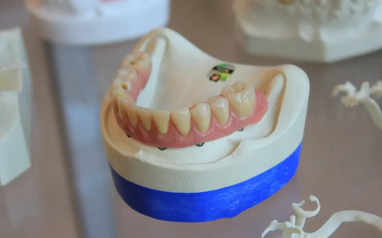 Comprehensive Dental Implants Price Guide: What You Need to Know for Different Age Groups
