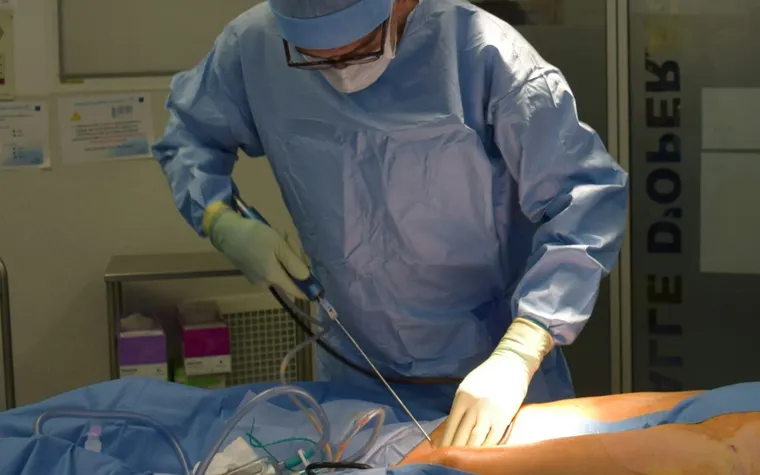 Top 10 Hospitals Offering Free Liposuction