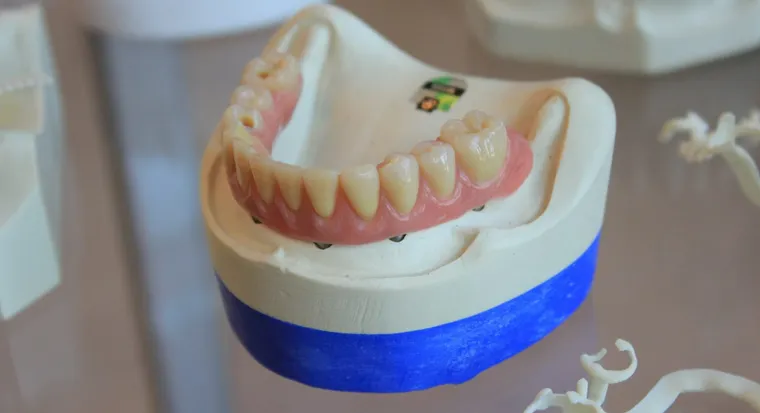 Understanding Same Day Dentures: A Quick Guide