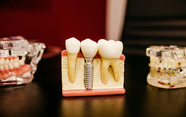 Explore the costs of dental implants with our comprehensive guide