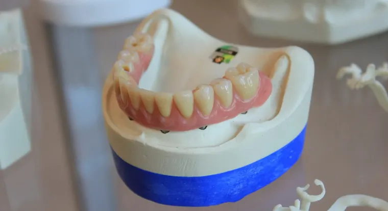 Explore our comprehensive dentures price list. Quality solutions for every budget.