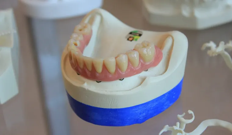 Understanding Same Day Dentures for Seniors: A Quick Guide