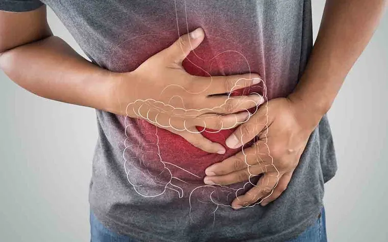Understanding Ulcerative Colitis: Symptoms, Causes, and Treatment Options