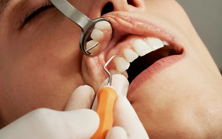 Screwless Dental Implants: A Painless, Modern Solution for a Natural Smile