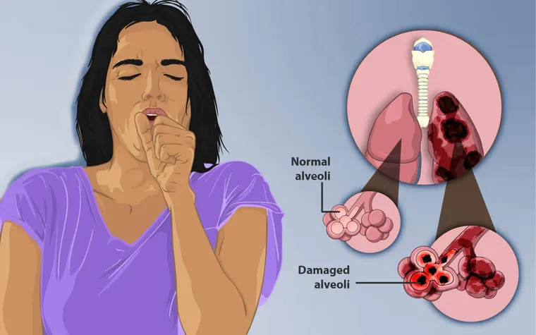 COPD Treatments Uncovered: Effective Strategies to Breathe Easier and Live Better