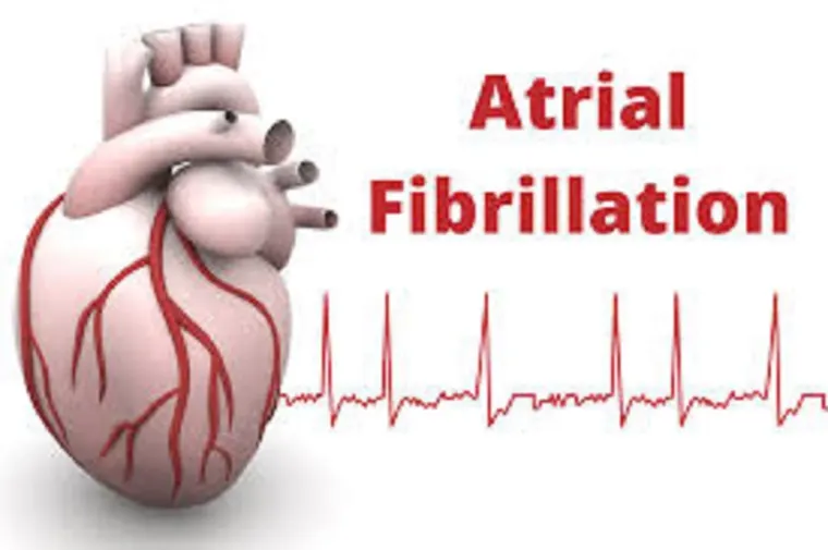 Atrial Fibrillation: Recognizing and Managing the Irregular Heartbeat That Puts Your Health at Risk