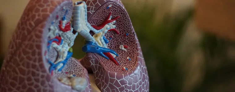 Natural Ways to Support Pulmonary Hypertension Management