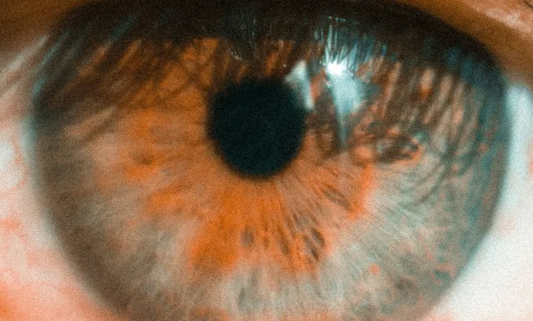 What Are the Causes of Macular Degeneration?