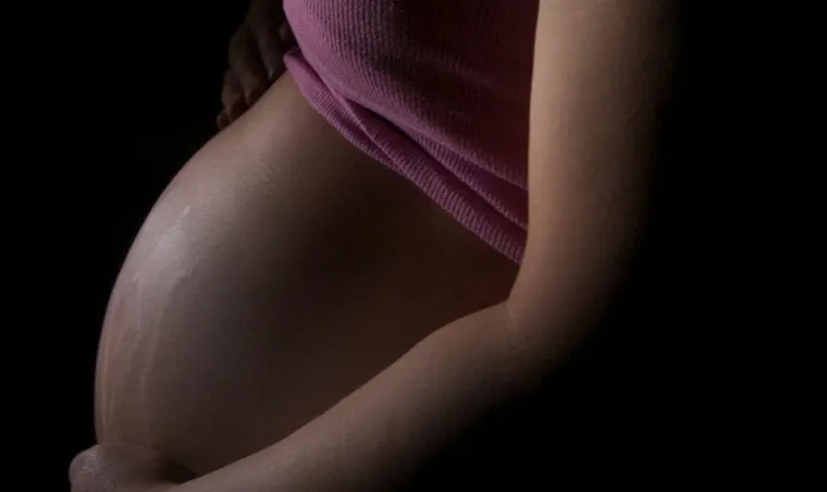 Laser Stretch Mark Removal: Cost, Results, and Best Treatment Options