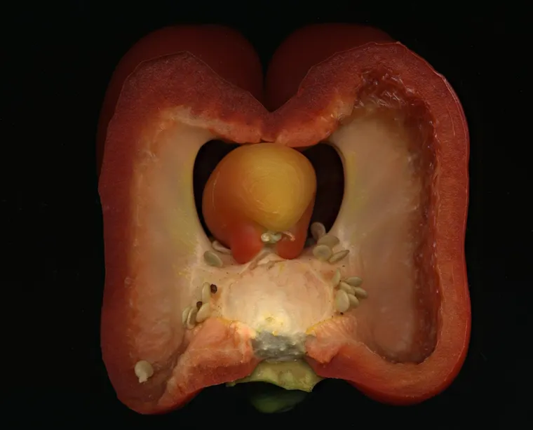 Eosinophilic Esophagitis