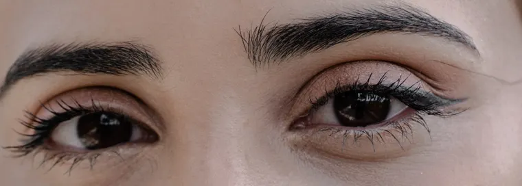 Eyebrow Hair Transplants: What You Should Know in 2025