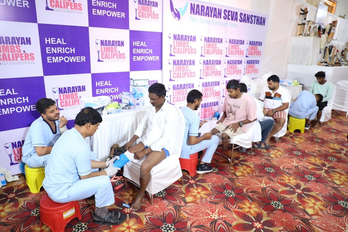 3D-Printed Narayan modular limbs provide self-reliant life