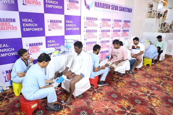 3D-Printed Narayan modular limbs provide self-reliant life