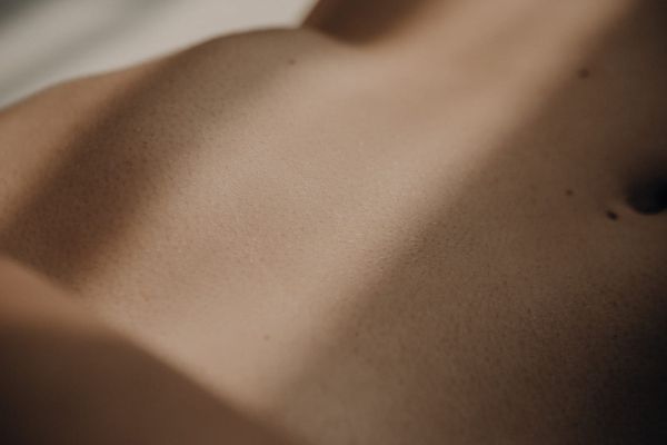 Rete Ovarii