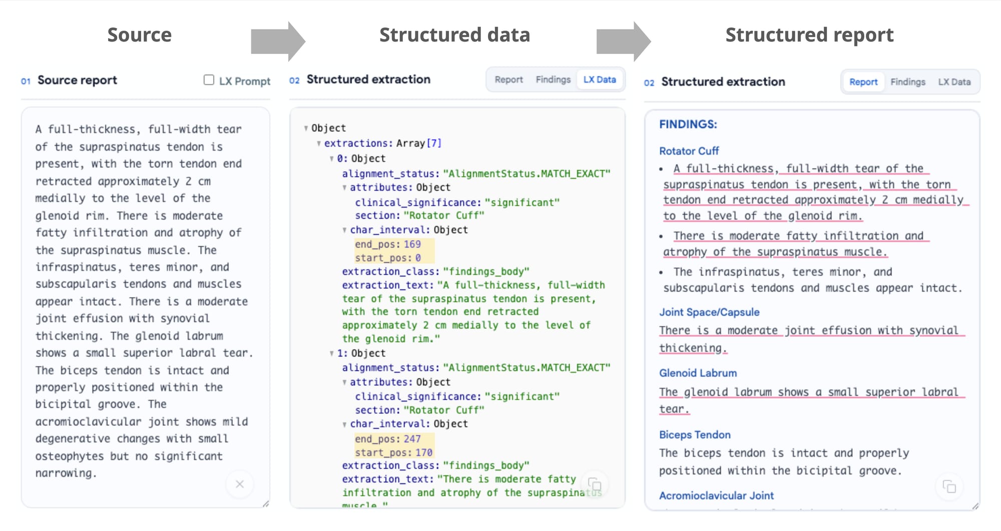 Screenshots showing unstructured text transformed to structured data and report