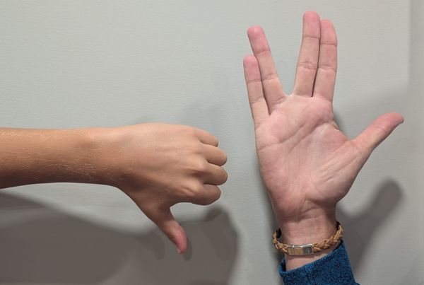 Photograph of two hands against a plain background. On the right, a hand making the Vulcan 'live long and prosper' symbol. Left, an arm extended with a decisive thumbs down.