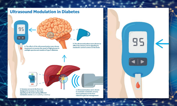 Inyulface GE RESEARCH traitement du diabète par ultrasons