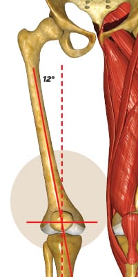 Q-Angle Training with an arthritic knee or a patellar tracking problem isn’t a deal breaker that will leave you crippled, but it does mean you should be cautious. These conditions can cause further injuries or simply become worse, making training more painful and less than desirable to keep doing.  Management for both conditions includes stretching and strengthening exercises to keep the muscles in the knee balanced. Physiotherapy modalities including ultrasound, cold laser and Kinesio taping are also good options to keep pain under control. Cross training, bicycling and general lower body strengthening is always a good idea.