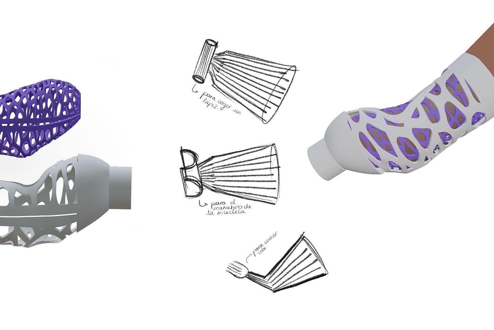 A purple and white lattice prosthetic socket on an arm, with design sketches beside it